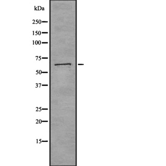 CTPS Antibody - Western blot analysis of CTPS using K562 whole cells lysates