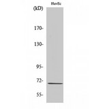 CTPS Antibody - Western blot of CTPS antibody