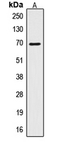 CTPS Antibody - Western blot analysis of CTPS expression in HepG2 (A) whole cell lysates.
