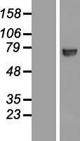 CTPS Protein - Western validation with an anti-DDK antibody * L: Control HEK293 lysate R: Over-expression lysate