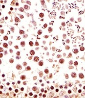 CTR9 Antibody - Immunohistochemical of paraffin-embedded M. testis section using Mouse Ctr9 antibody diluted at 1:25 dilution. A undiluted biotinylated goat polyvalent antibody was used as the secondary, followed by DAB staining.