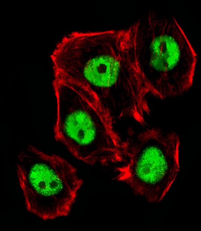 CTR9 Antibody - Fluorescent image of A431 cells stained with Mouse Ctr9 antibody diluted at 1:25 dilution. An Alexa Fluor 488-conjugated goat anti-rabbit lgG at 1:400 dilution was used as the secondary antibody (green). Cytoplasmic actin was counterstained with Alexa Fluor 555 conjugated with Phalloidin (red).