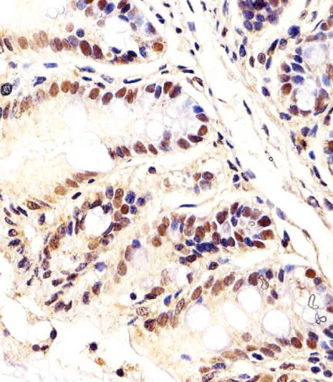 CTR9 Antibody - Immunohistochemical of paraffin-embedded M. colon section using Mouse Ctr9 antibody diluted at 1:25 dilution. A undiluted biotinylated goat polyvalent antibody was used as the secondary, followed by DAB staining.
