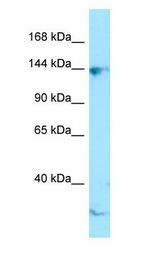 CTR9 Antibody - CTR9 antibody Western Blot of Jurkat.  This image was taken for the unconjugated form of this product. Other forms have not been tested.