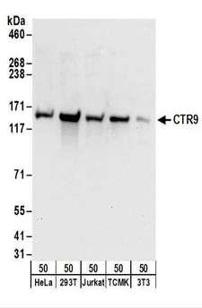 CTR9 Antibody - Detection of Human and Mouse CTR9 by Western Blot. Samples: Whole cell lysate (50 ug) from HeLa, 293T, Jurkat, mouse TCMK-1, and mouse NIH3T3 cells. Antibodies: Affinity purified rabbit anti-CTR9 antibody used for WB at 0.1 ug/ml. Detection: Chemiluminescence with an exposure time of 10 seconds.