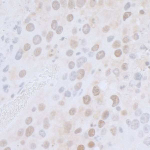CTR9 Antibody - Detection of mouse CTR9 by immunohistochemistry. Sample: FFPE section of mouse renal cell carcinoma. Antibody: Affinity purified rabbit anti-CTR9 used at a dilution of 1:5,000 (0.2µg/ml). Detection: DAB