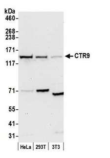 CTR9 Antibody - Detection of human and mouse CTR9 by western blot. Samples: Whole cell lysate (50 µg) from HeLa, HEK293T, and mouse NIH 3T3 cells prepared using NETN lysis buffer. Antibody: Affinity purified rabbit anti-CTR9 antibody used for WB at 0.1 µg/ml. Detection: Chemiluminescence with an exposure time of 30 seconds.