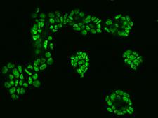 CTR9 Antibody - Immunofluorescence staining of CTR9 in RT4 cells. Cells were fixed with 4% PFA, permeabilzed with 0.1% Triton X-100 in PBS, blocked with 10% serum, and incubated with rabbit anti-Human CTR9 polyclonal antibody (dilution ratio 1:200) at 4°C overnight. Then cells were stained with the Alexa Fluor 488-conjugated Goat Anti-rabbit IgG secondary antibody (green). Positive staining was localized to Nucleus.
