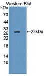 CTRB1 / Chymotrypsinogen B1 Antibody - Western blot of CTRB1 / Chymotrypsinogen B1 antibody.