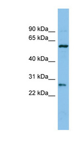 CTRB1 / Chymotrypsinogen B1 Antibody - CTRB1 antibody Western blot of COLO205 cell lysate. This image was taken for the unconjugated form of this product. Other forms have not been tested.