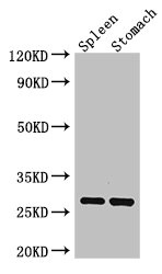 CTRB1 / Chymotrypsinogen B1 Antibody - Western Blot Positive WB detected in: mouse spleen tissue, Mouse stomach tissue All lanes: CTRB1 antibody at 3µg/ml Secondary Goat polyclonal to rabbit IgG at 1/50000 dilution Predicted band size: 28 kDa Observed band size: 28 kDa