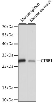 CTRB1 / Chymotrypsinogen B1 Antibody - Western blot analysis of extracts of various cell lines, using CTRB1 antibody at 1:1000 dilution. The secondary antibody used was an HRP Goat Anti-Rabbit IgG (H+L) at 1:10000 dilution. Lysates were loaded 25ug per lane and 3% nonfat dry milk in TBST was used for blocking. An ECL Kit was used for detection and the exposure time was 5s.