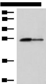 CTRB1 / Chymotrypsinogen B1 Antibody - Western blot analysis of Rat pancreas tissue and Mouse pancreas tissue lysates  using CTRB1 Polyclonal Antibody at dilution of 1:1000