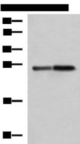 CTRB1 / Chymotrypsinogen B1 Antibody - Western blot analysis of Mouse pancreas tissue and Rat pancreas tissue lysates  using CTRB1 Polyclonal Antibody at dilution of 1:1000