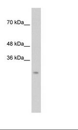 CTRL Antibody - Transfected 293T Cell Lysate.  This image was taken for the unconjugated form of this product. Other forms have not been tested.