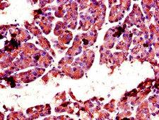 CTRL Antibody - Immunohistochemistry of paraffin-embedded human pancreatic tissue using CTRL Antibody at dilution of 1:100
