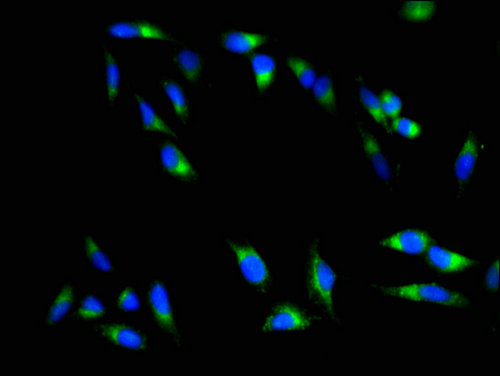 CTRL Antibody - Immunofluorescent analysis of Hela cells using CTRL Antibody at a dilution of 1:100 and Alexa Fluor 488-congugated AffiniPure Goat Anti-Rabbit IgG(H+L)