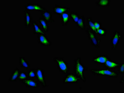 CTRL Antibody - Immunofluorescent analysis of Hela cells using CTRL Antibody at dilution of 1:100 and Alexa Fluor 488-congugated AffiniPure Goat Anti-Rabbit IgG(H+L)