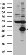 CTRL Antibody - HEK293T cells were transfected with the pCMV6-ENTRY control. (Left lane) or pCMV6-ENTRY CTRL. (Right lane) cDNA for 48 hrs and lysed