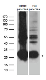 CTRL Antibody - Western blot analysis of extracts. (35ug) from different cell lines and tissues by using anti-CTRL rabbit polyclonal antibody.