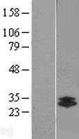 CTRL Protein - Western validation with an anti-DDK antibody * L: Control HEK293 lysate R: Over-expression lysate