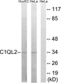 CTRP10 / C1QL2 Antibody - Western blot analysis of lysates from HeLa and HUVEC cells, using C1QL2 Antibody. The lane on the right is blocked with the synthesized peptide.