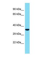 CTRP10 / C1QL2 Antibody - Western blot of C1QL2 Antibody - middle region with human Fetal heart cells lysate.  This image was taken for the unconjugated form of this product. Other forms have not been tested.