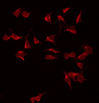CTRP10 / C1QL2 Antibody - Staining HeLa cells by IF/ICC. The samples were fixed with PFA and permeabilized in 0.1% Triton X-100, then blocked in 10% serum for 45 min at 25°C. The primary antibody was diluted at 1:200 and incubated with the sample for 1 hour at 37°C. An Alexa Fluor 594 conjugated goat anti-rabbit IgG (H+L) Ab, diluted at 1/600, was used as the secondary antibody.