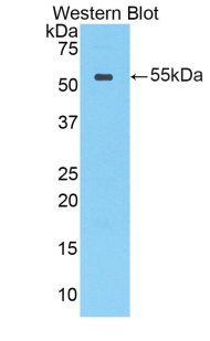 CTSA / Cathepsin A Antibody - Western blot of recombinant CTSA / Cathepsin A.  This image was taken for the unconjugated form of this product. Other forms have not been tested.