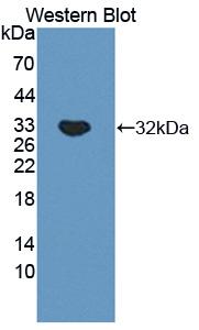 CTSA / Cathepsin A Antibody - Western blot of CTSA / Cathepsin A antibody.