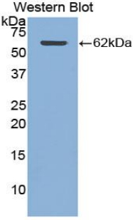 CTSA / Cathepsin A Antibody - Western blot of recombinant CTSA / Cathepsin A.  This image was taken for the unconjugated form of this product. Other forms have not been tested.