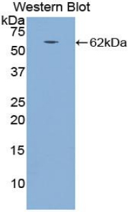 CTSA / Cathepsin A Antibody - Western blot of recombinant CTSA / Cathepsin A.  This image was taken for the unconjugated form of this product. Other forms have not been tested.