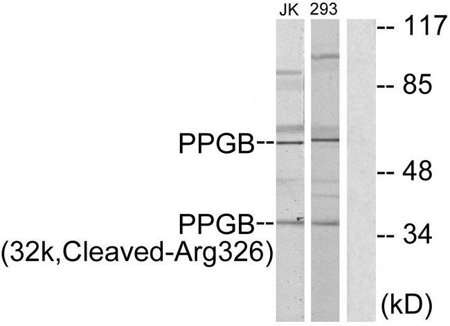 CTSA / Cathepsin A Antibody - Western blot analysis of extracts from Jurkat cells and 293 cells, treated with etoposide (25uM, 1hour), using PPGB (32k, Cleaved-Arg326) antibody.