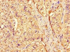 CTSA / Cathepsin A Antibody - Immunohistochemistry of paraffin-embedded human adrenal gland tissue using CTSA Antibody at dilution of 1:100