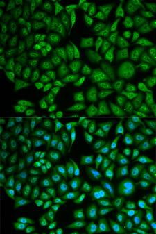 CTSA / Cathepsin A Antibody - Immunofluorescence analysis of MCF-7 cells using CTSA Polyclonal Antibody.