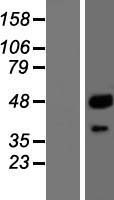 CTSA / Cathepsin A Protein - Western validation with an anti-DDK antibody * L: Control HEK293 lysate R: Over-expression lysate