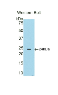 CTSB / Cathepsin B Antibody - Western blot of recombinant CTSB / Cathepsin B.  This image was taken for the unconjugated form of this product. Other forms have not been tested.