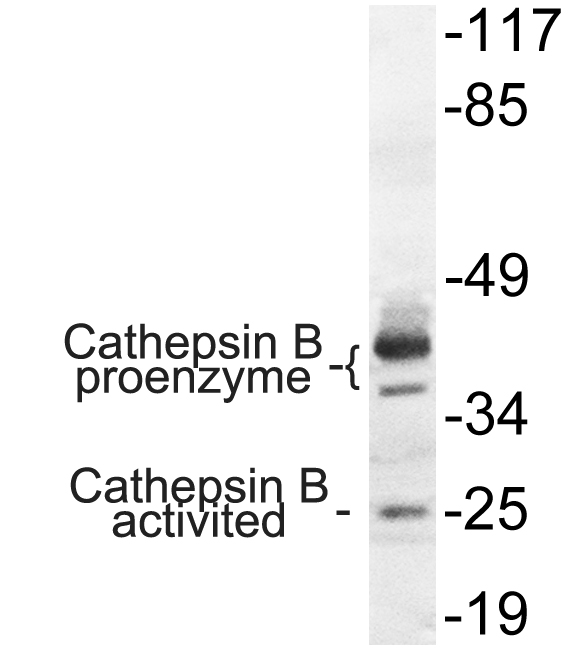 CTSB / Cathepsin B Antibody - Western blot analysis of lysate from COLO cells, using Cathepsin B antibody.