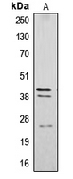 CTSB / Cathepsin B Antibody - Western blot analysis of Cathepsin B expression in SW480 (A) whole cell lysates.