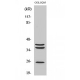 CTSB / Cathepsin B Antibody - Western blot of Cathepsin B antibody