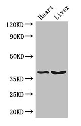 CTSB / Cathepsin B Antibody - Western Blot Positive WB detected in: mouse heart tissue, Mouse liver tissue All lanes: CTSB antibody at 3µg/ml Secondary Goat polyclonal to rabbit IgG at 1/50000 dilution Predicted band size: 38 kDa Observed band size: 38 kDa