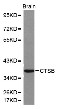 CTSB / Cathepsin B Antibody - Western blot analysis of brain cell lysate.