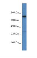 CTSC / Cathepsin C / JP Antibody - Western blot of Human HCT15. CTSC antibody dilution 1.0 ug/ml.  This image was taken for the unconjugated form of this product. Other forms have not been tested.