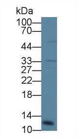 CTSC / Cathepsin C / JP Antibody - Western Blot; Sample: Human Placenta lysate; Primary Ab: 2µg/ml Rabbit Anti-Human CTSC Antibody Second Ab: 0.2µg/mL HRP-Linked Caprine Anti-Rabbit IgG Polyclonal Antibody