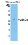 CTSC / Cathepsin C / JP Antibody - Western blot of recombinant CTSC / Cathepsin C / JP.  This image was taken for the unconjugated form of this product. Other forms have not been tested.