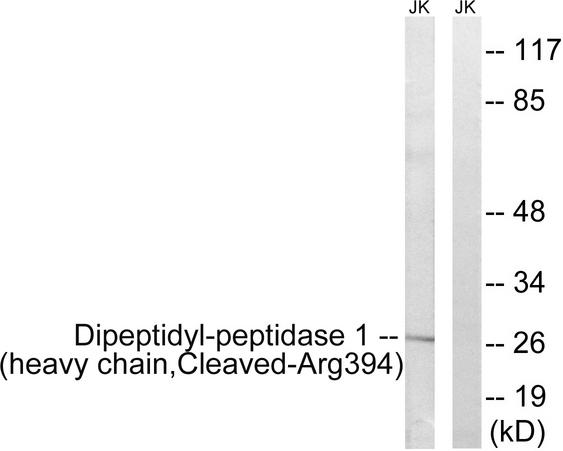 CTSC / Cathepsin C / JP Antibody - Western blot analysis of extracts from Jurkat cells, treated with etoposide (25uM, 1hour), using Dipeptidyl-peptidase 1 (heavy chain, Cleaved-Arg394) antibody.