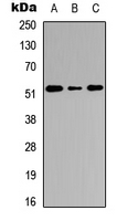 CTSC / Cathepsin C / JP Antibody - Western blot analysis of Cathepsin C HC expression in HEK293T (A); Raw264.7 (B); PC12 (C) whole cell lysates.