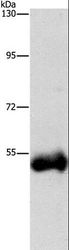 CTSC / Cathepsin C / JP Antibody - Western blot analysis of Human placenta tissue, using CTSC Polyclonal Antibody at dilution of 1:1000.