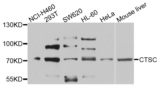 CTSC / Cathepsin C / JP Antibody - Western blot analysis of extracts of various cells.