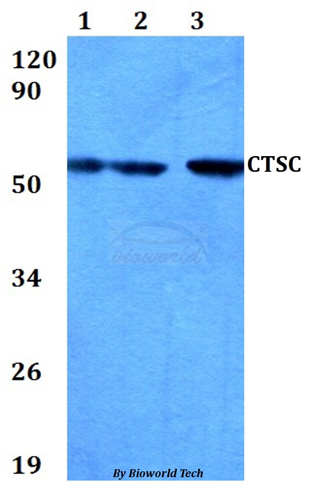 CTSC / Cathepsin C / JP Antibody - Western blot of CTSC antibody at 1:500 dilution. Lane 1: HEK293T whole cell lysate. Lane 2: Raw264.7 whole cell lysate. Lane 3: PC12 whole cell lysate.